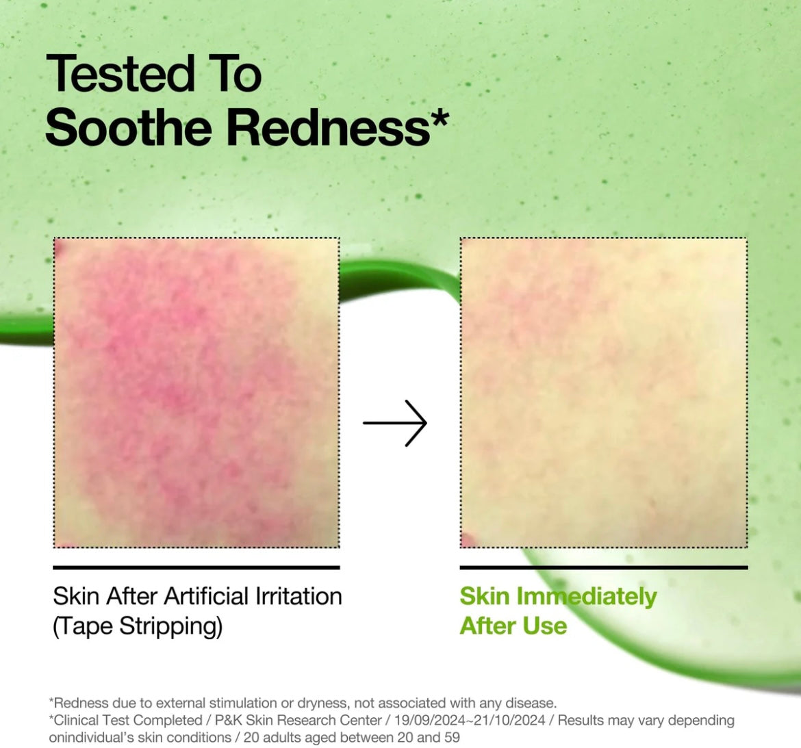 Azelaic Acid 10 Hyaluron Redness Soothing Serum 30ml